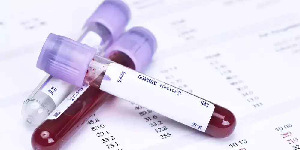 Biomonitoring PFAS : de nouvelles prises de sang proposées suite à une sous-estimation des résultats