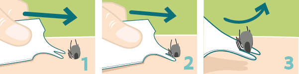 Carte à tiques.png