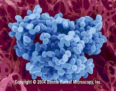 3.1_enterococcus.jpg