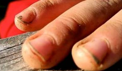 ongles.png